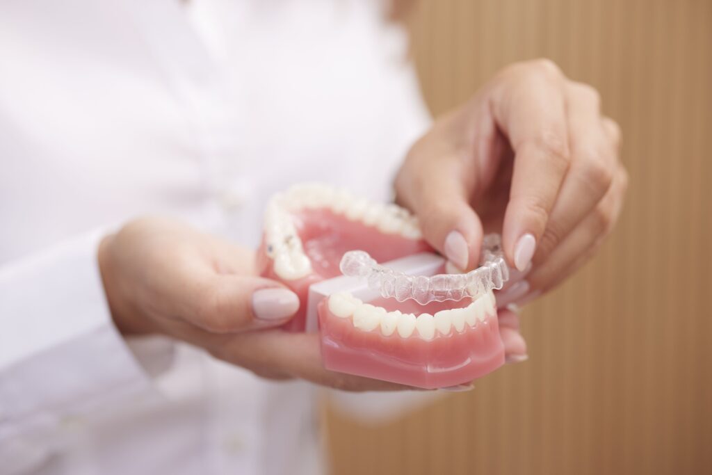 Gebissmodell mit eingesetztem Invisalign-Aligner, gehalten von einer Hand. Das Bild gehört zur kieferorthopädischen Fachzahnarztpraxis Biss & Bogen in Ratingen-Lintorf.