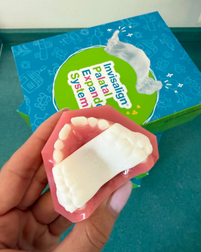 Oberkiefer-Modell mit weißem, 3D-gedrucktem Invisalign Palatal Expander zur Gaumennahterweiterung, in einer Hand gehalten. Das rosafarbene Modell zeigt die weißen Zähne des Oberkiefers, der Expander liegt am Gaumen auf und umfasst die hinteren Backenzähne. Im Hintergrund die blau-grüne Verpackung des Invisalign Palatal Expander Systems, darauf ein weiterer, transparenter Expander. Aufnahme aus der Kieferorthopädie Biss & Bogen in Ratingen.
